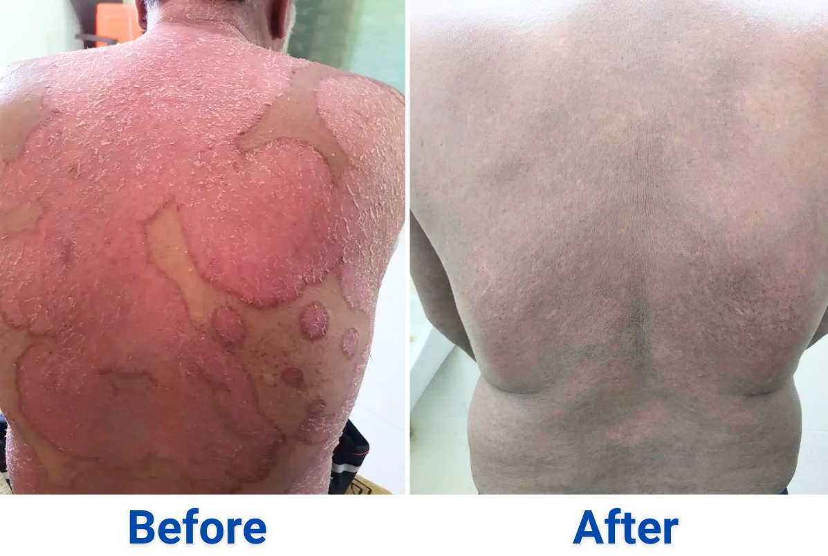 After treatment, case 6