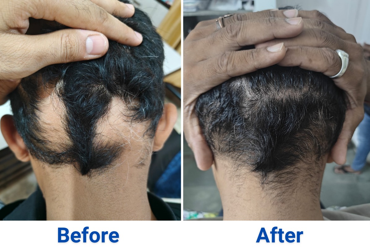 After treatment, case 5
