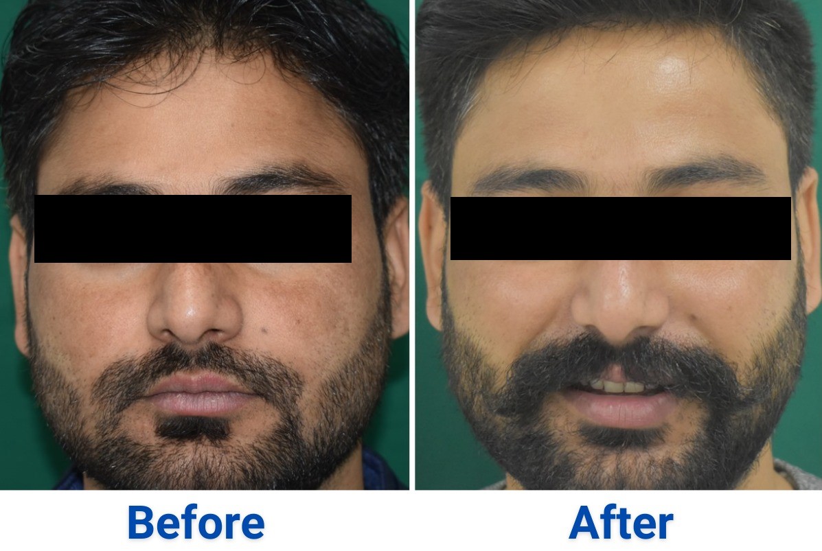 After treatment, case 2