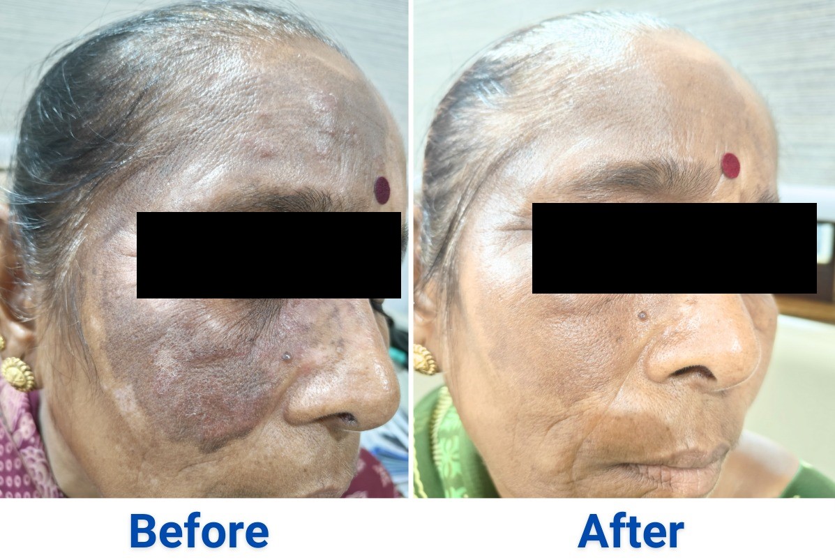 After treatment, case 3