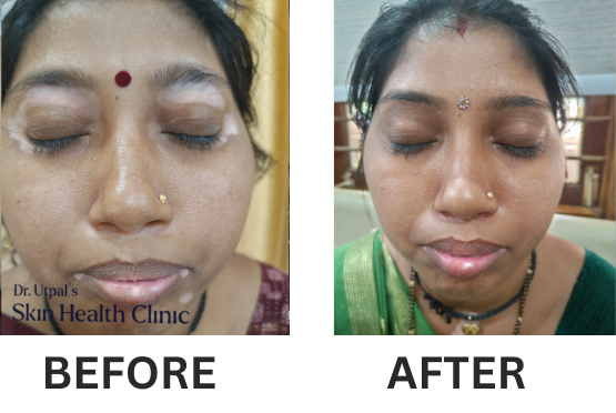 After treatment, case 14