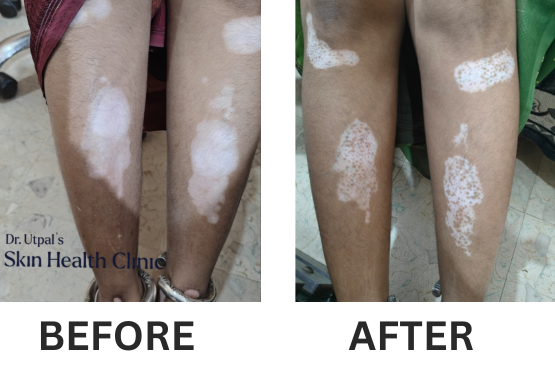 After treatment, case 15