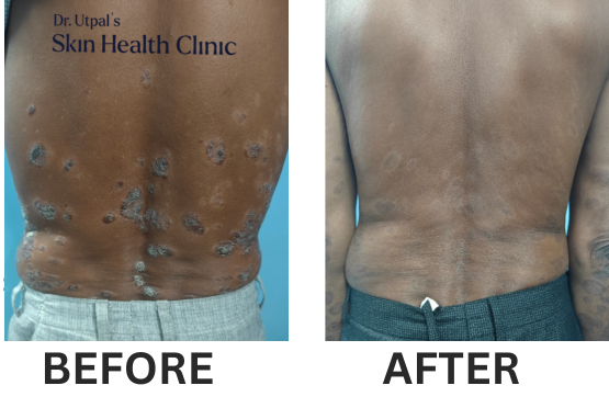 After treatment, case 16