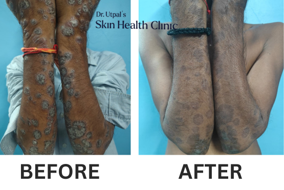 After treatment, case 17