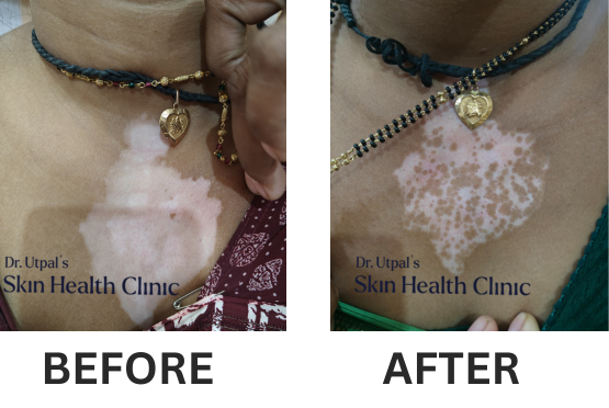 After treatment, case 13
