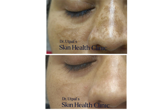 After treatment, case 12