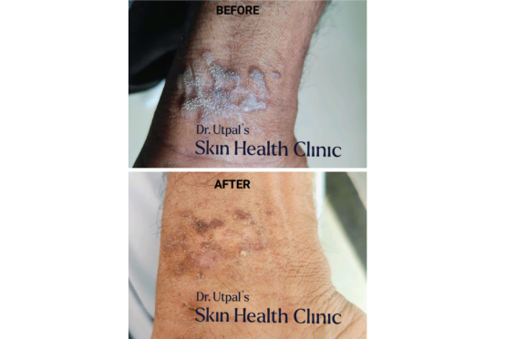 After treatment, case 11