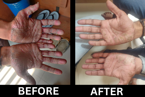 After treatment, case 8