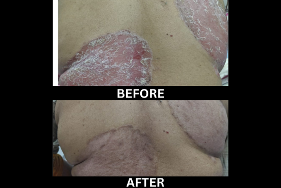 After treatment, case 9