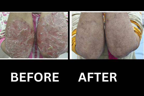 After treatment, case 10