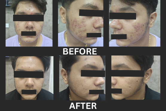 After treatment, case 7